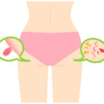 よもぎ蒸しで痔の痛みが楽になる?誰にも言えない悩みを解決しよう!